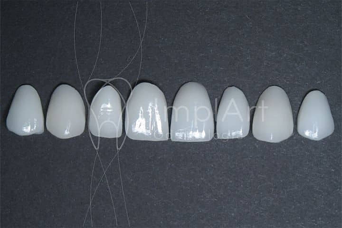 Lentes de porcelana